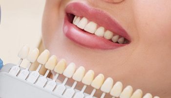 What are Dental Veneers: Types, Procedure & Benefits