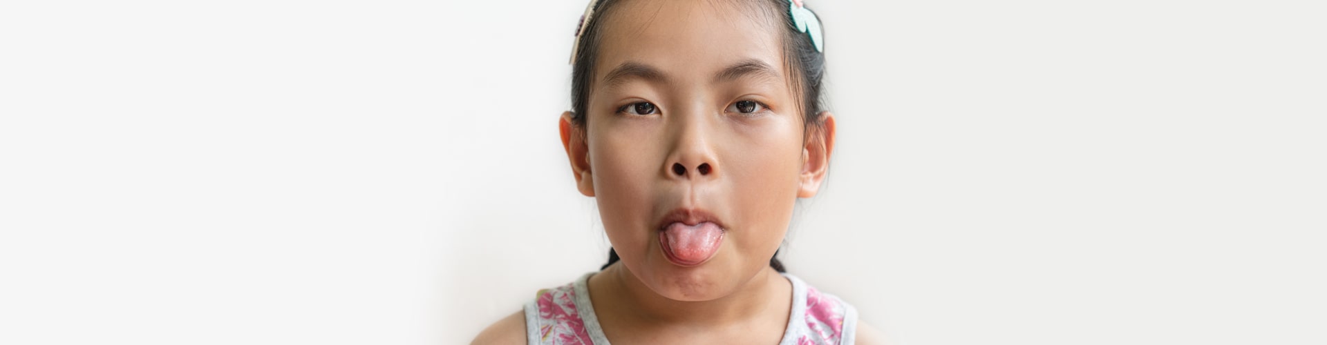 Tongue Tie