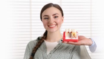 Exploring the Latest Trends in Dental Implants