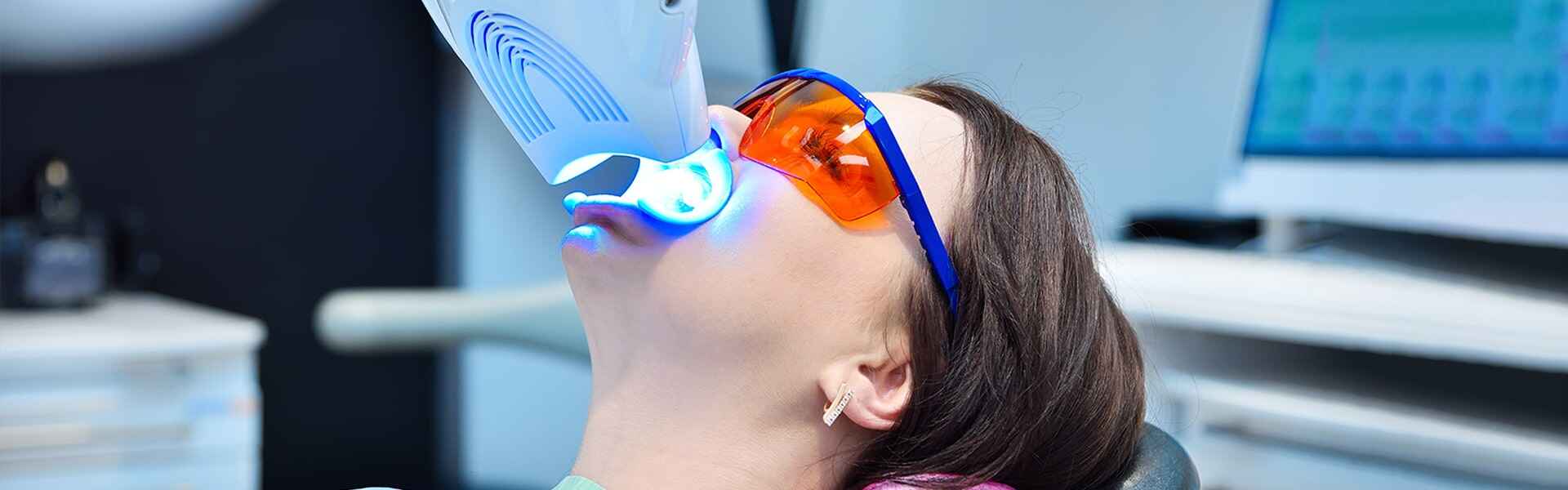 How Long Do Teeth Whitening Results Last?