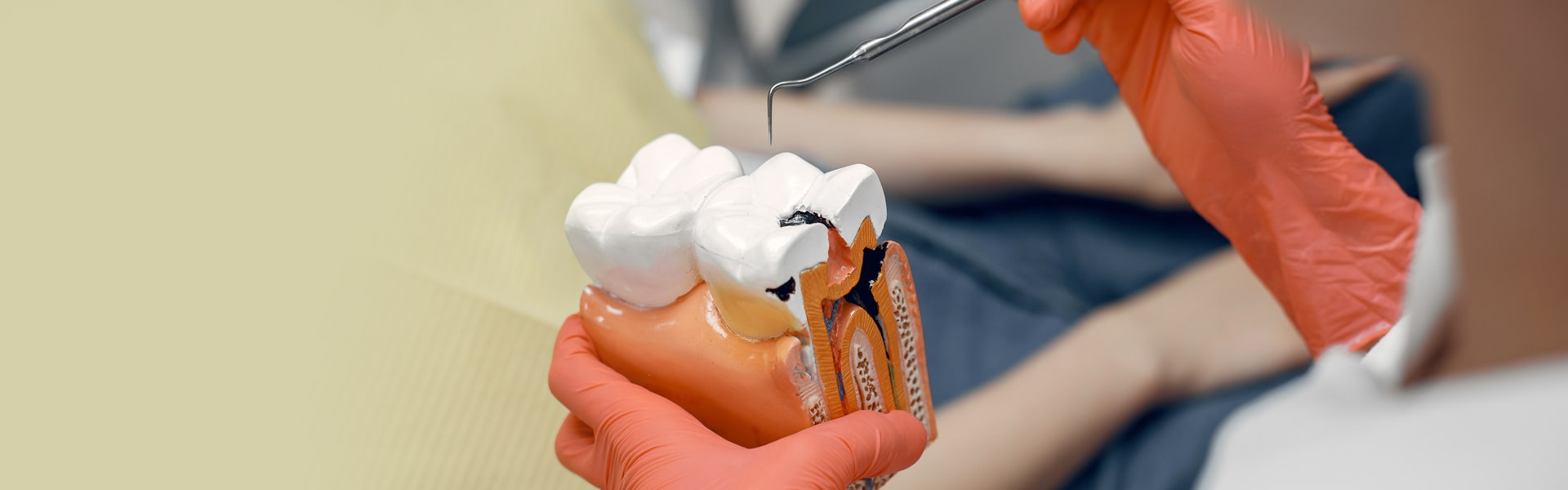 How to Prevent Future Infections After Root Canal Therapy