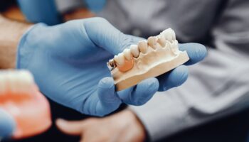 What Are the Different Types of Dental Bridges?