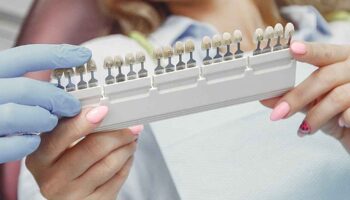 Key Things to Know Before Getting Veneers