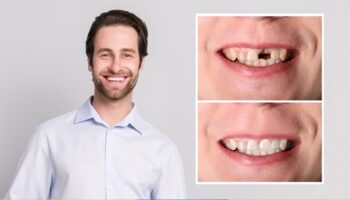 Choosing the Right Dental Crown: Why Material Matters More Than You Think