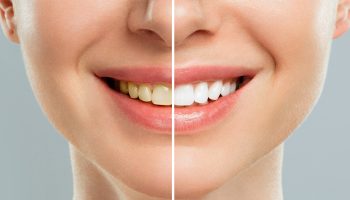 The Benefits of Professional Teeth Cleaning: Beyond Just Fresh Breath