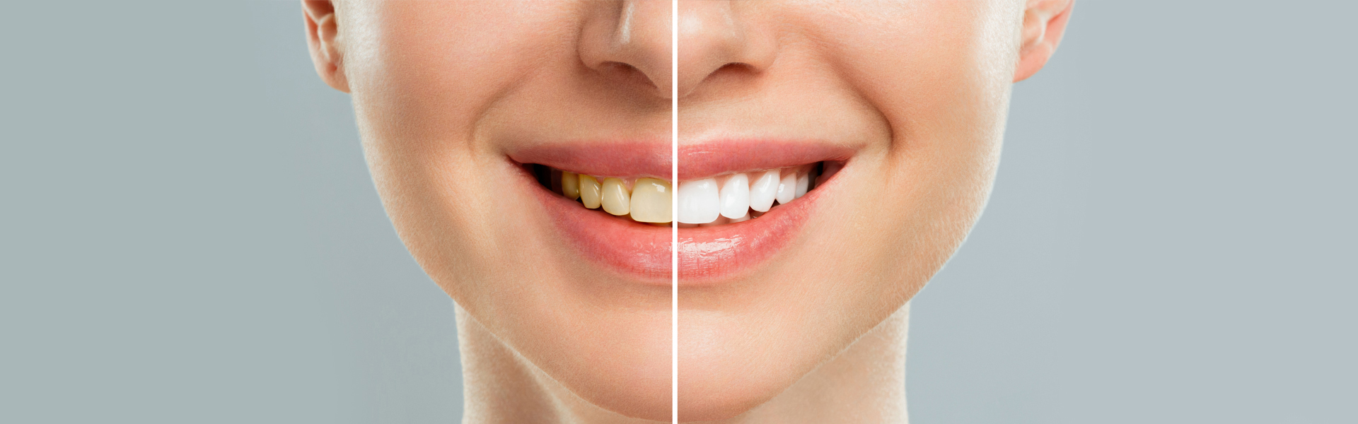 The Benefits of Professional Teeth Cleaning: Beyond Just Fresh Breath