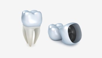 Why Dental Crowns Are Essential for Restoring a Damaged Tooth