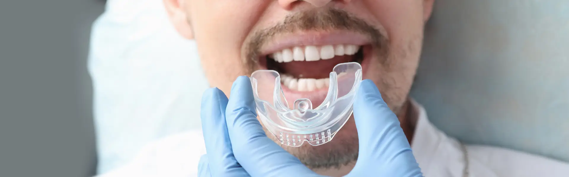How to Maintain Oral Hygiene While Wearing Invisalign Aligners