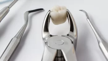 Tooth Extraction Complications and How You Can Avoid Them