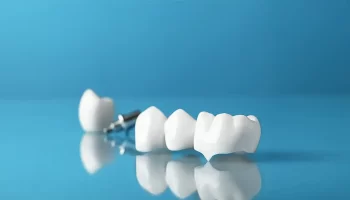 Top Reasons Why You Might Need Dental Crowns in Little Elm